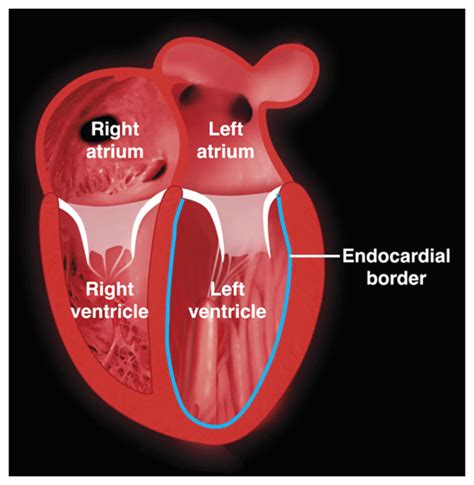 left ventricular lv|left ventricular function.